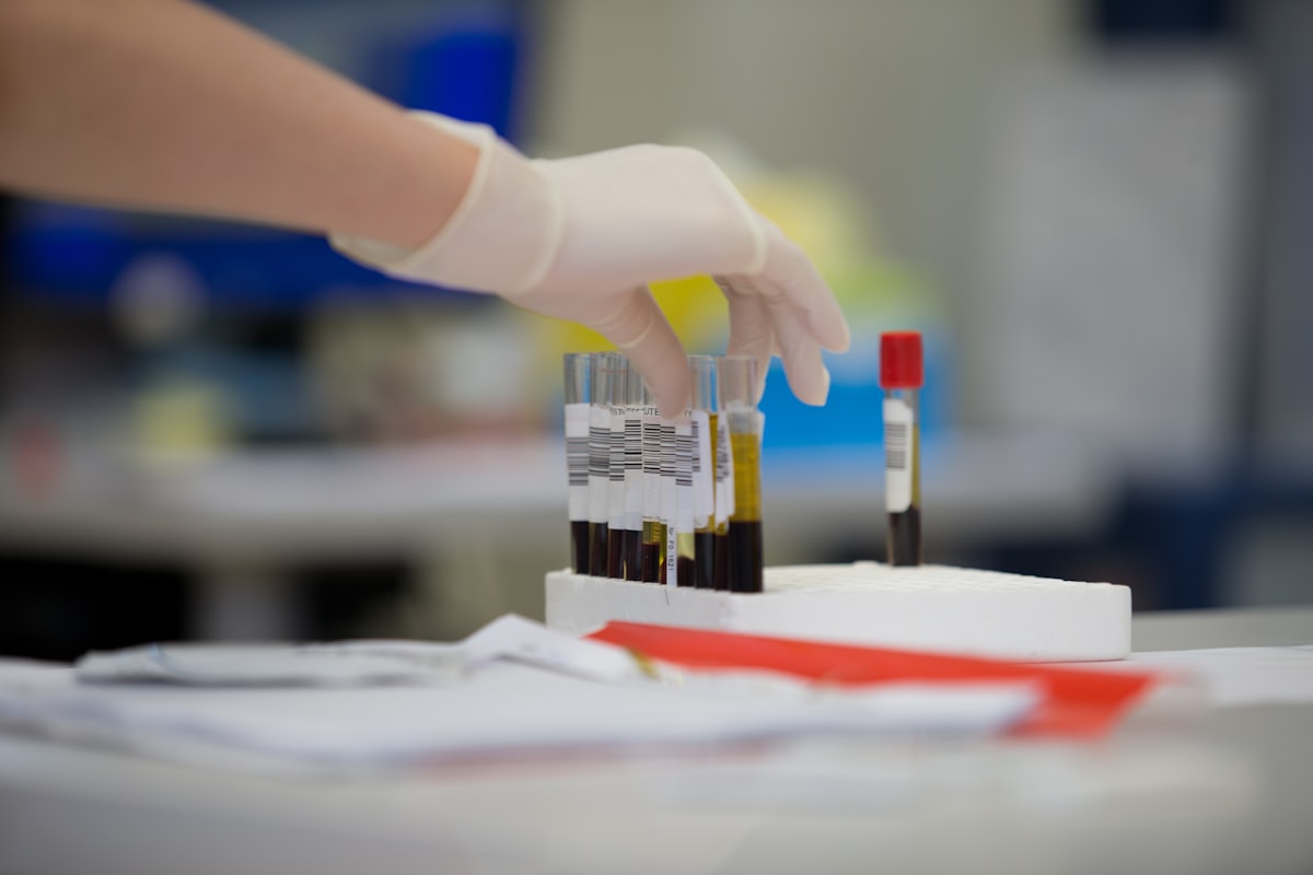 Mão com luva de procedimento segurando tubo de coleta com amostra biológica
